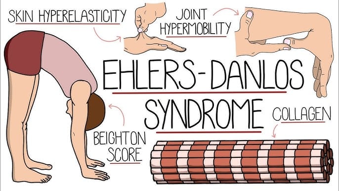 Ehlers-Danlos syndrome awareness